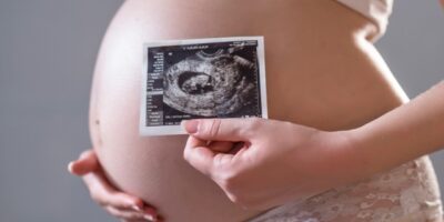 ecomorfologica ecomorfologica