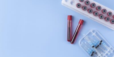 servizioprelievi servizioprelievi